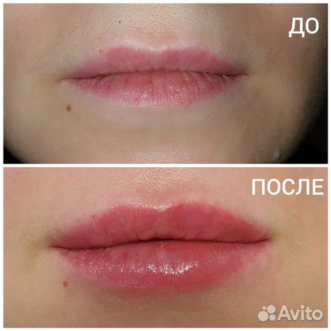 Авито Ханты Мансийске С Фото